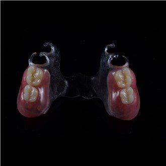 हटाने योग्य ऐक्रेलिक आंशिक डेन्चर