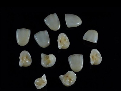 क्राउन के लिए सर्वोत्तम दंत गोंद कैसे चुनें: एक नवीनतम मार्गदर्शिका