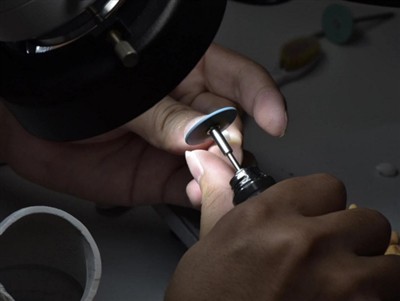 पीएफएम क्राउन कितने समय तक चलते हैं? औसत जीवनकाल, कारक और देखभाल युक्तियाँ